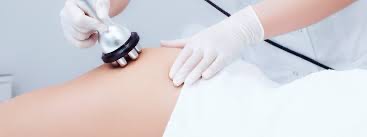6 Session RF Cellulite Treatment