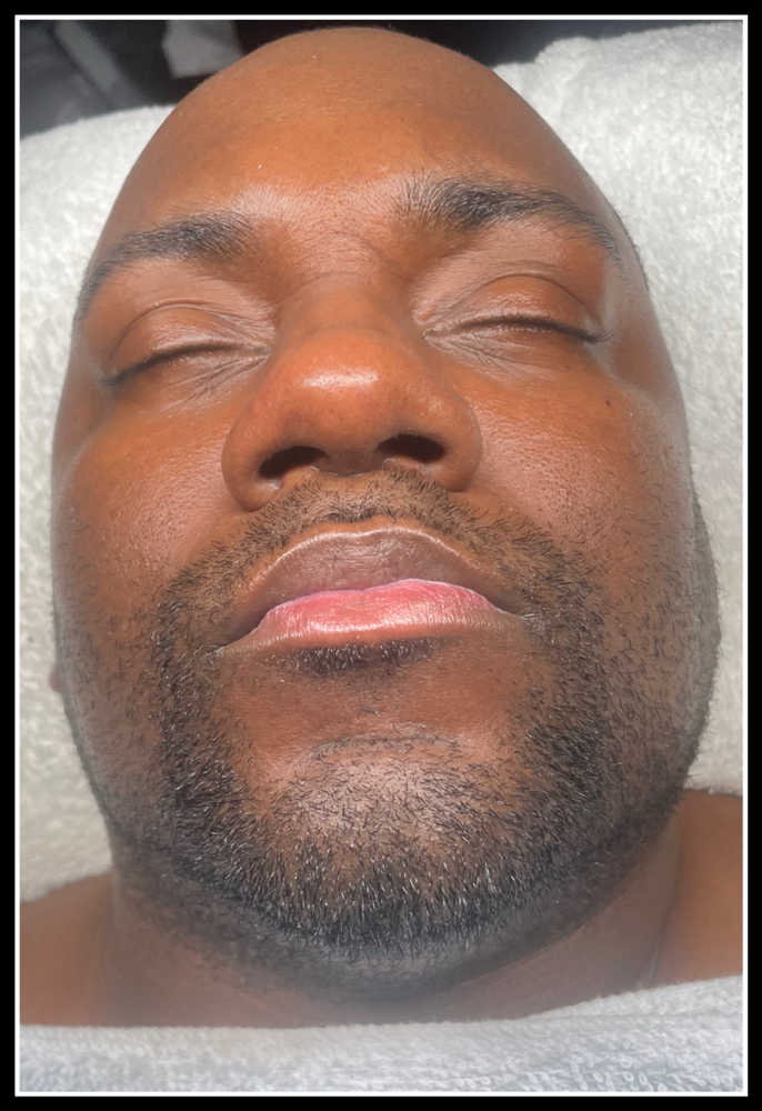 Beard Facial