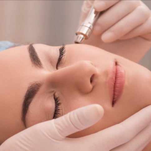 Mineral Infusion Facial at Rejuven Esthetic in vienna, VA