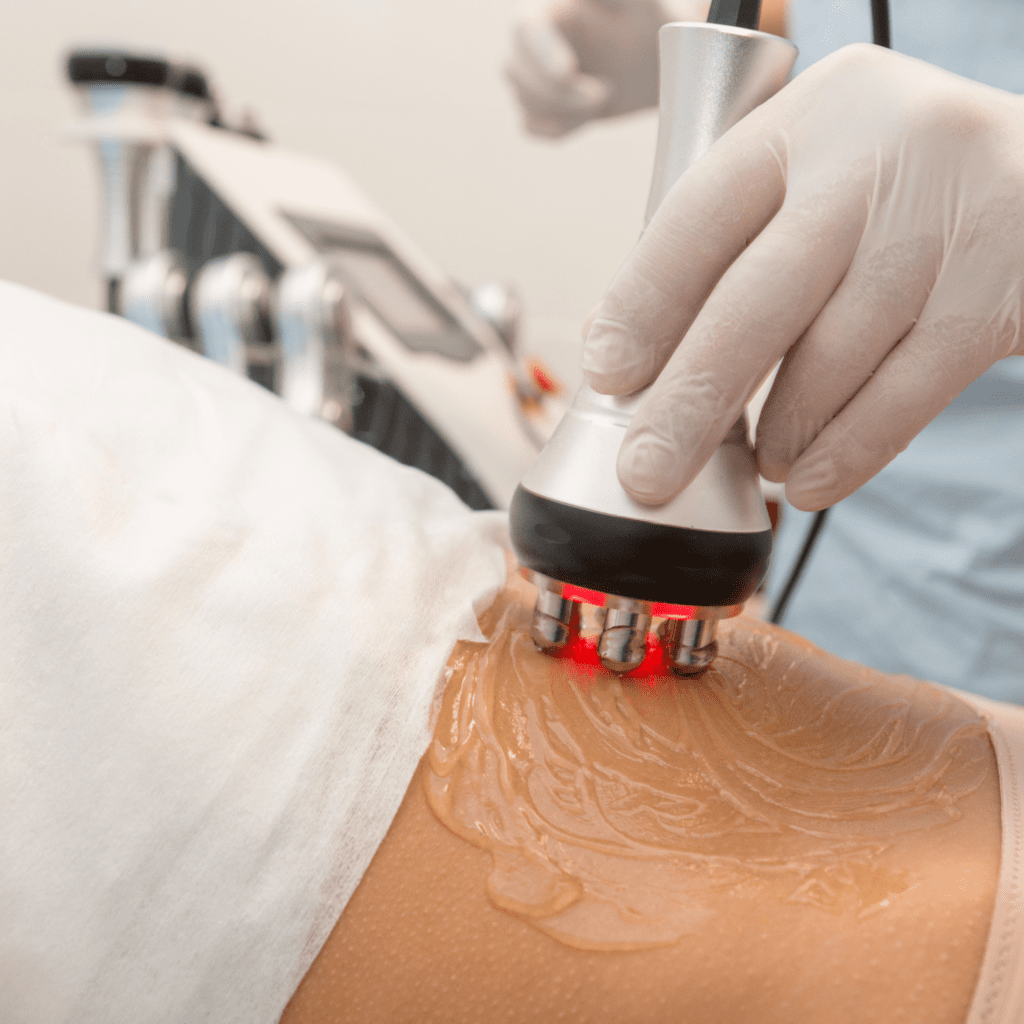 Body RF Tightening & Cavitation at Zen Beauty Lounge in Stroudsburg, PA