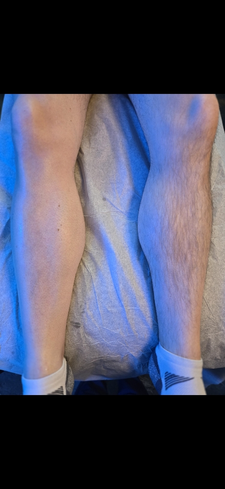 Full Leg