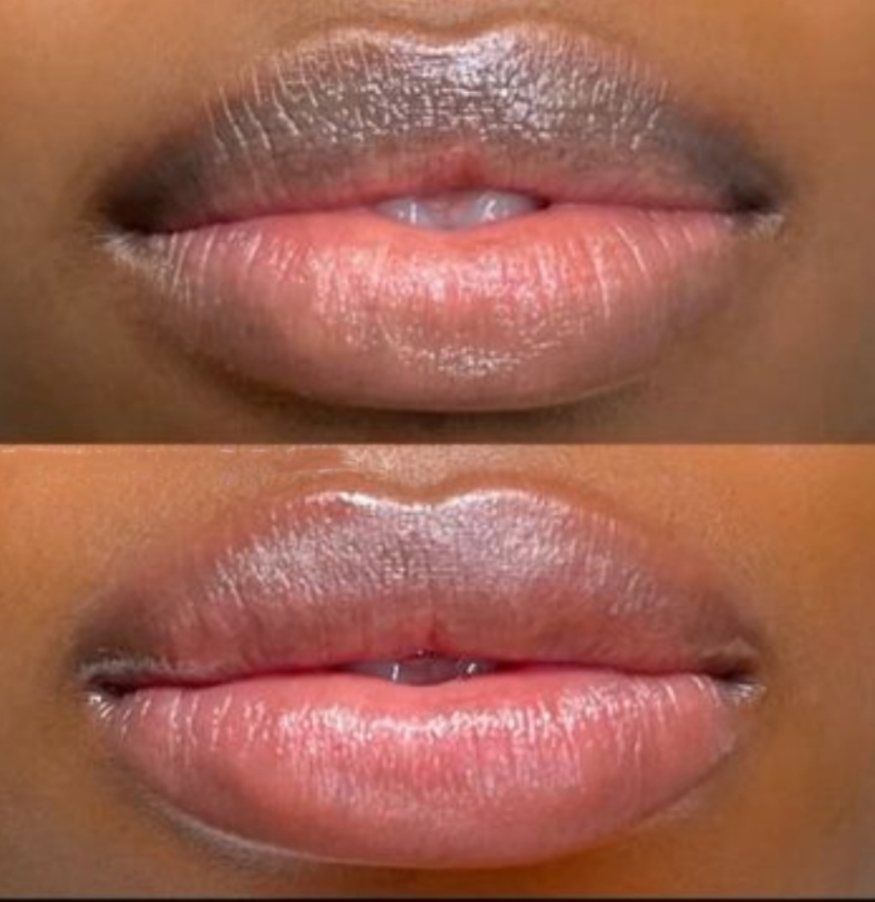 Lip Neutralization