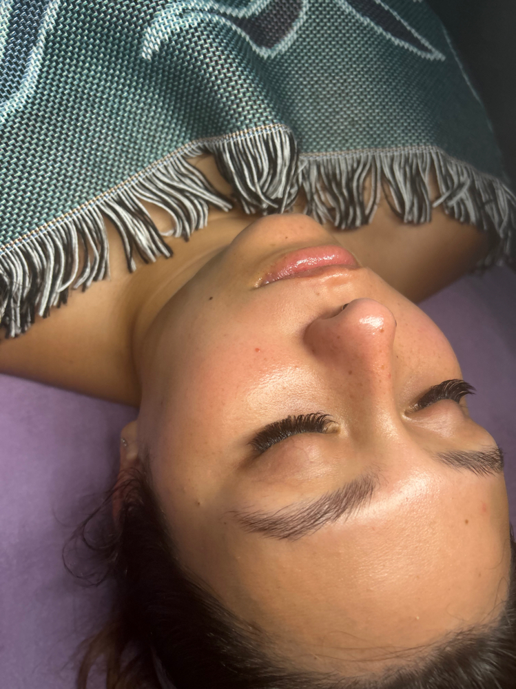 Microdermabrasion Facial