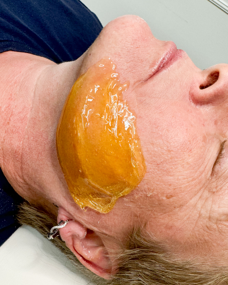 Full Face Sugaring