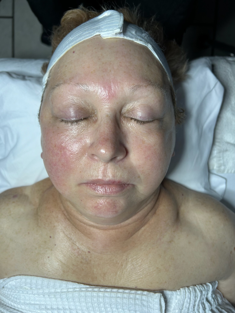 Lift & Sculpt Facial