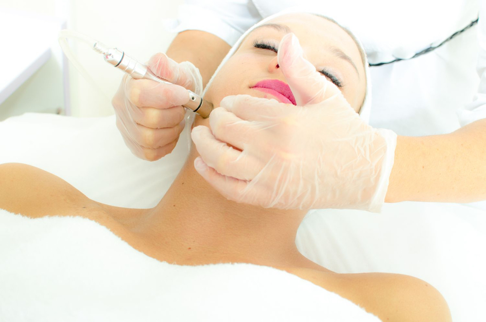 Microdermabrasion (Includes Mask)