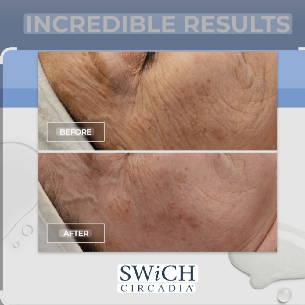 90 Min - Circadia SWiTCH Facial at Rest & Reset Esthetics in Bluffton, SC