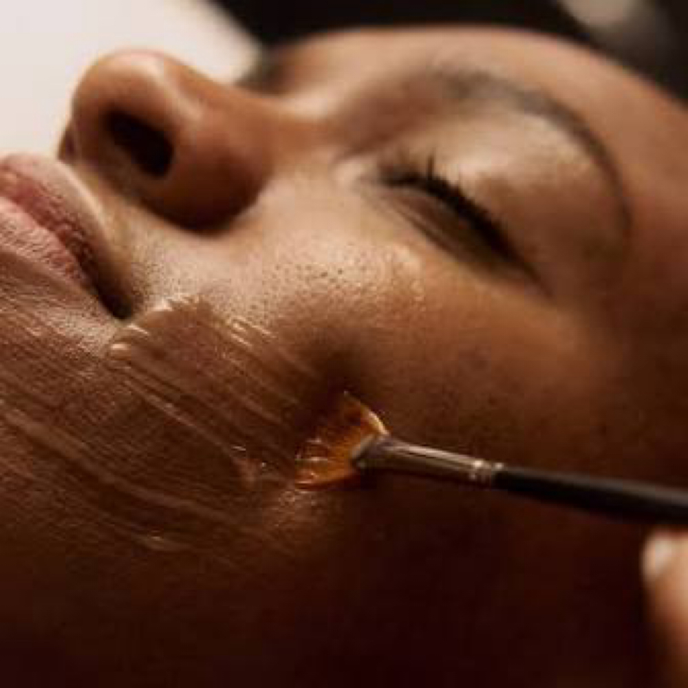 Acne/ Advanced Facial at Zahlani Luxe Beauty LLC in Valdosta, GA