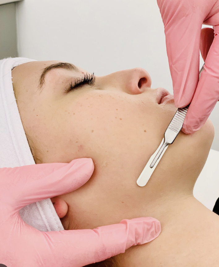 Dermaplane Facial