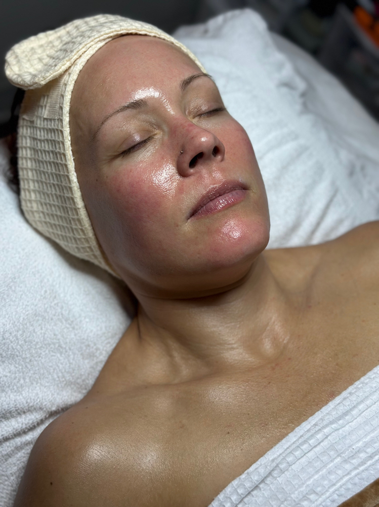 Dermaplane & Peel Combo Treatment