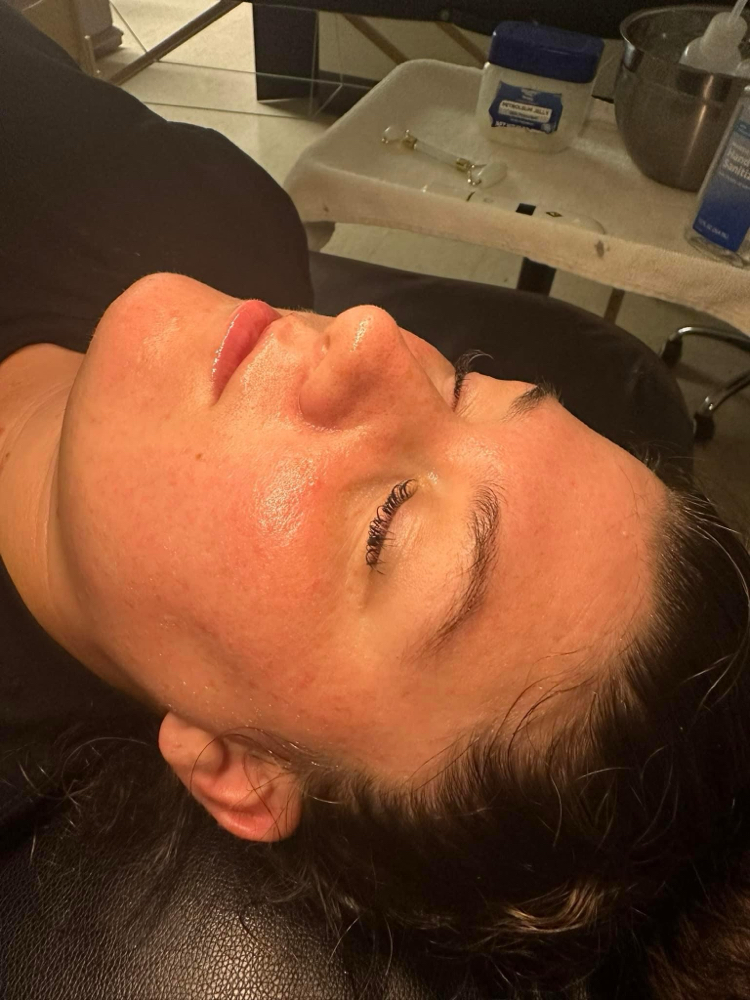 Free Skin Consultation