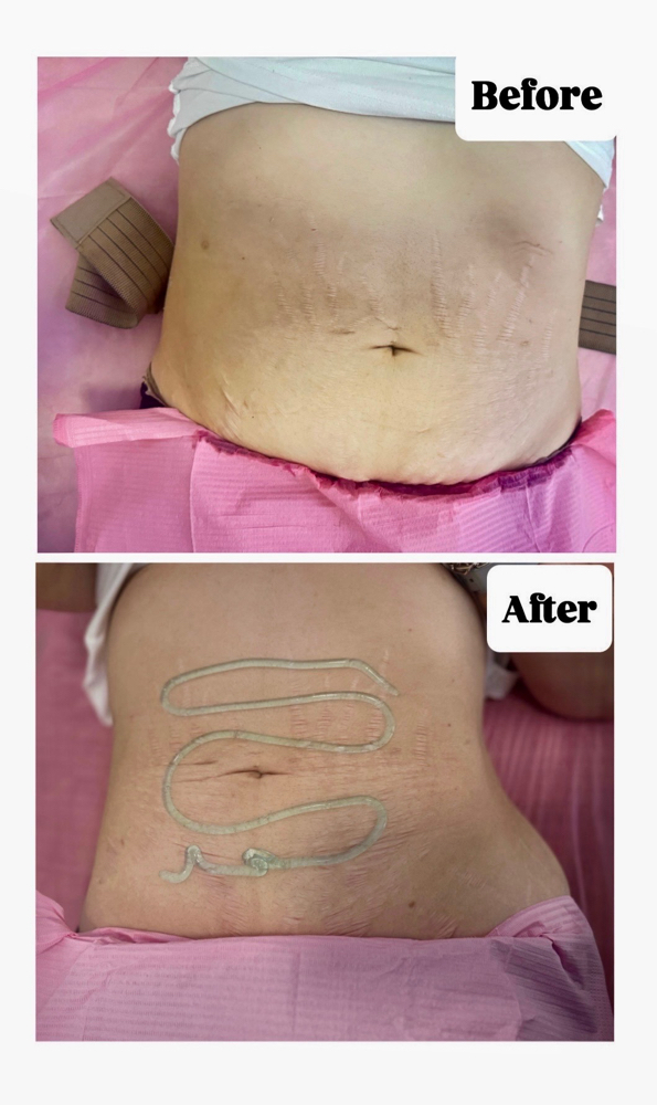 4 Slimming Sessions w/ Fat Burners