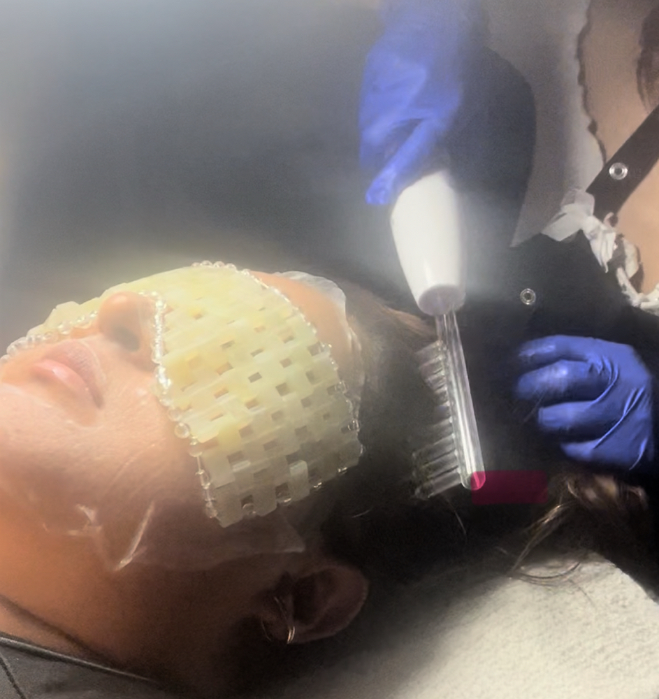 Scalp Therapy- Add On at Kohinoor Aesthetics By Marissa Elizabeth in San Antonio, TX
