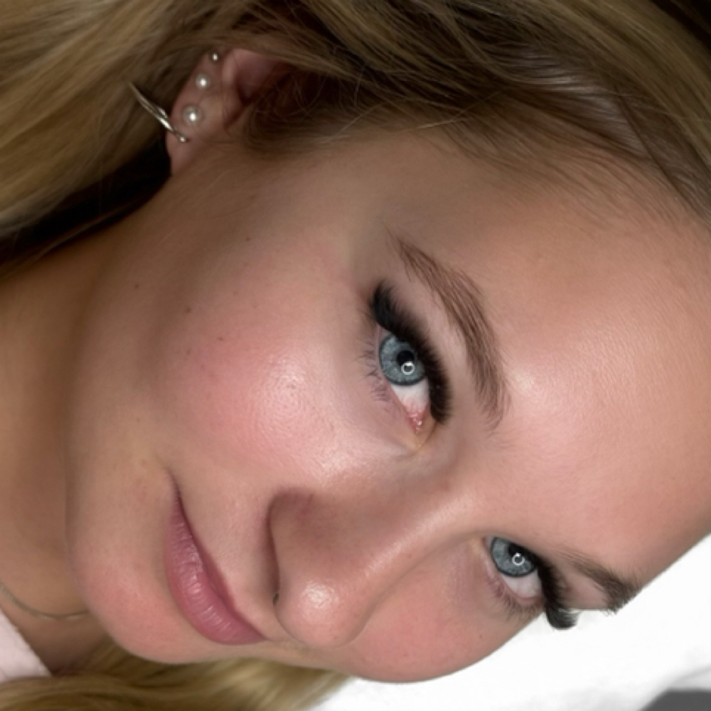 Volume Fill at .A. Blooming Beauty in Albany, NY