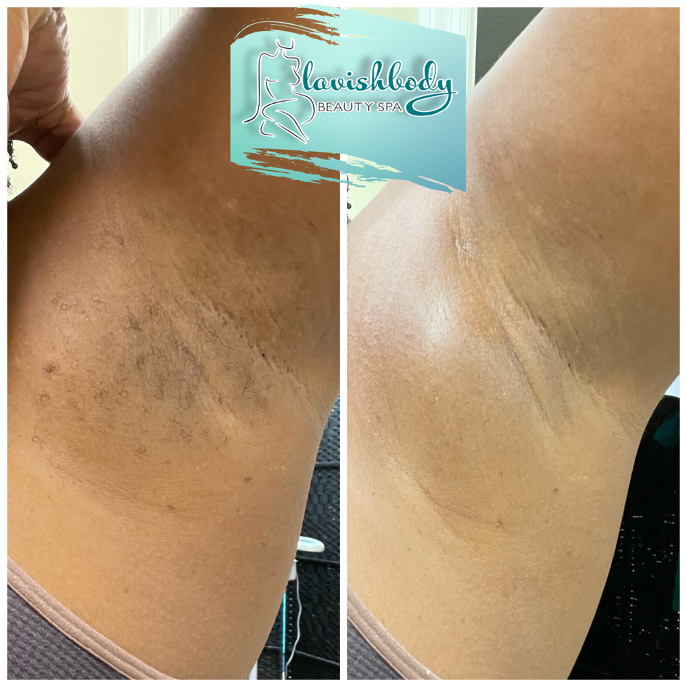 Underarm Wax