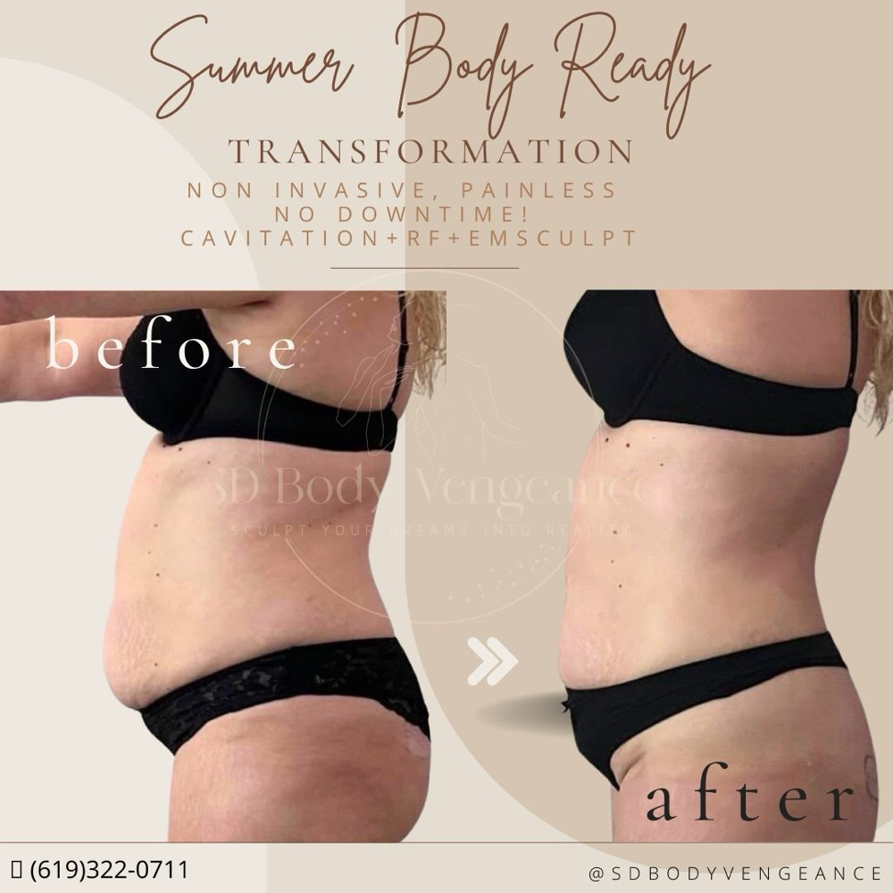 IceSculpt and Toned 2 weeks Program