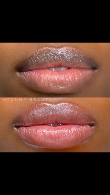 Lip Neutralization