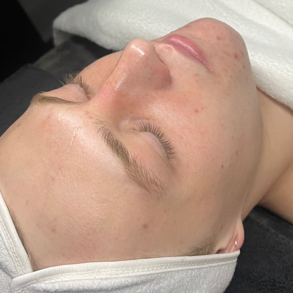 demaplane mini facial