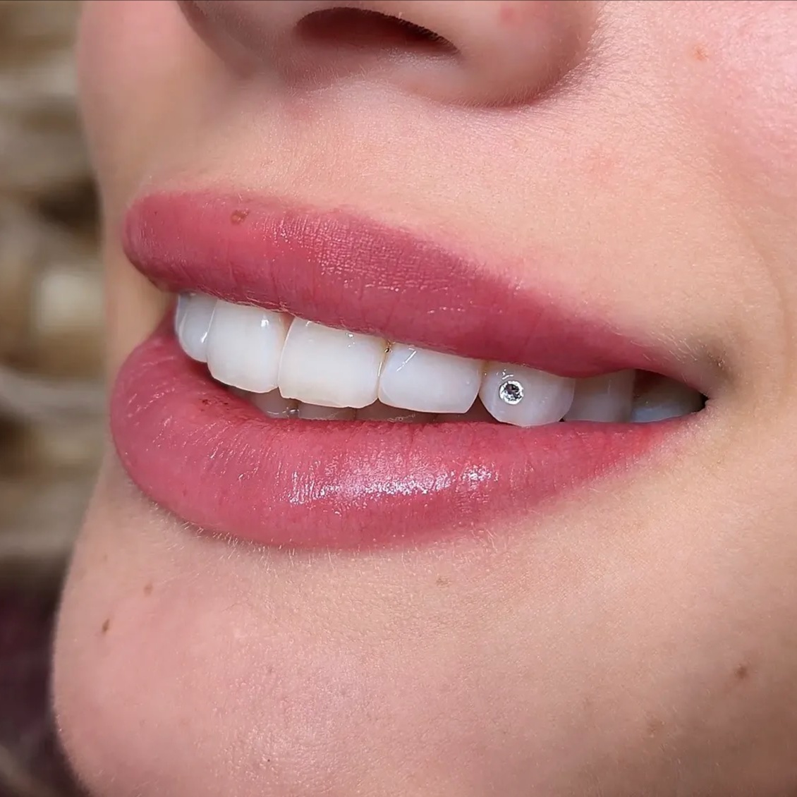1 Tooth Gem (Swarovski Crystal) at Royal Blanc Smiles - Teeth Whitening and Tooth Gems in Charlotte, NC in Charlotte, NC