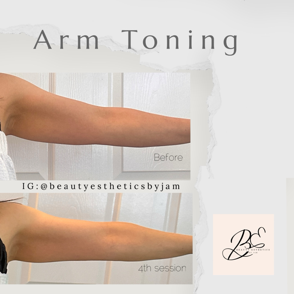 Arm Toning
