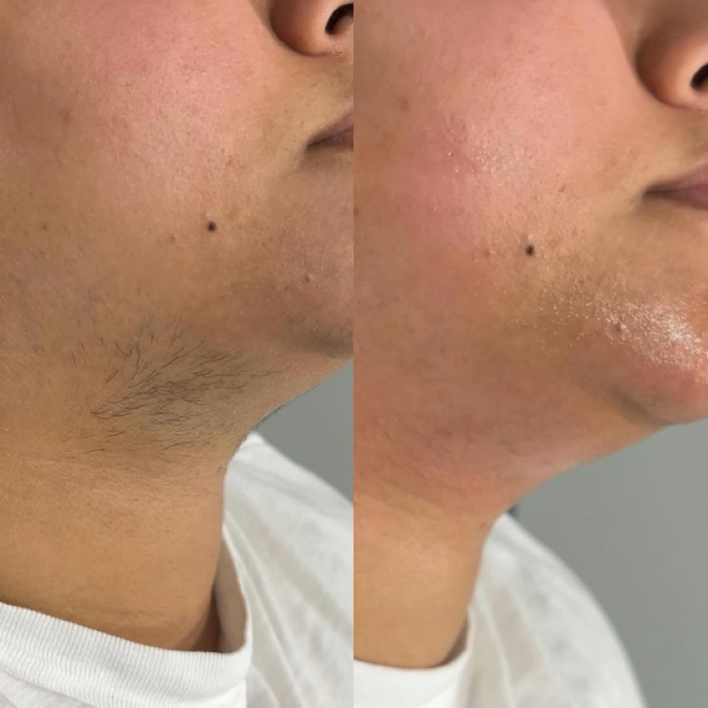 Chin Wax at Mel Esthetics LLC in Denver City, TX