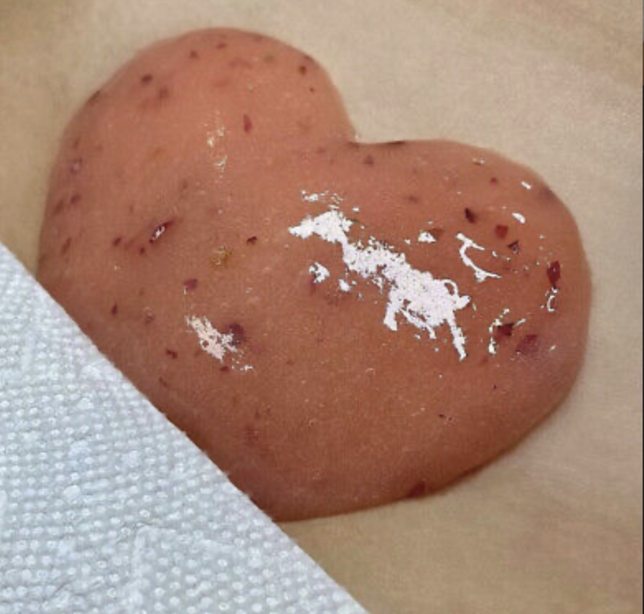 Vajacial Treatment
