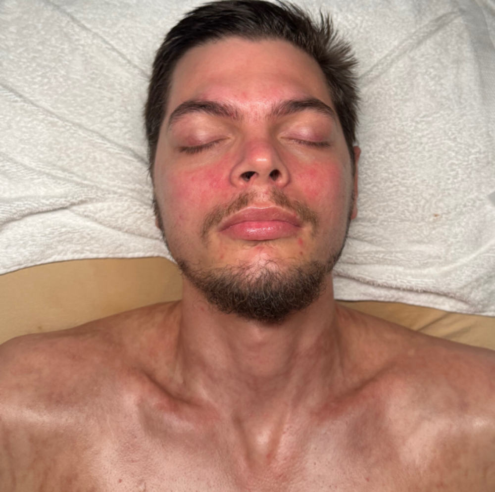 Tier 1 Facial at Lane Luxury Esthetics in Bartlesville, OK