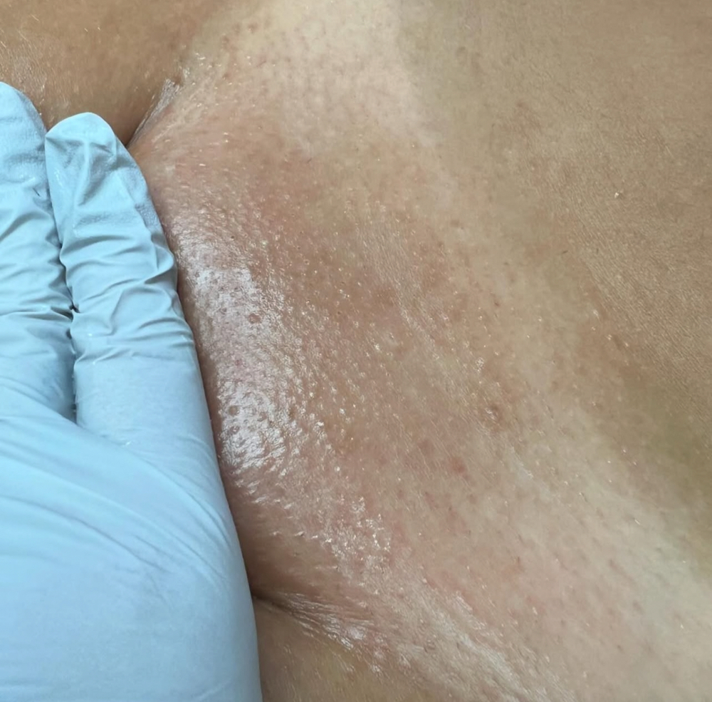 Brazilian Wax (4-6 Weeks) at Lè Glamour Bar in St. Thomas, VI