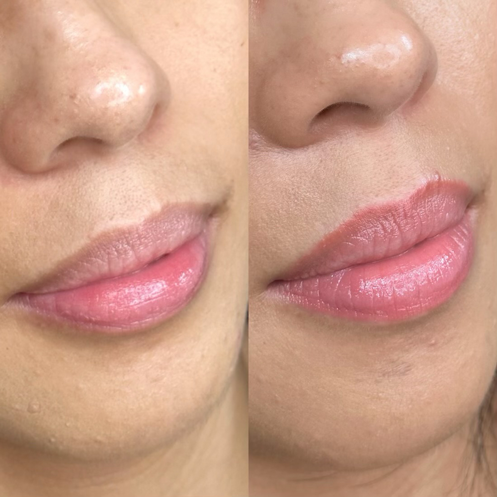 Dark Lip Neutralizacion at Lirba Beauty in Henderson, NV