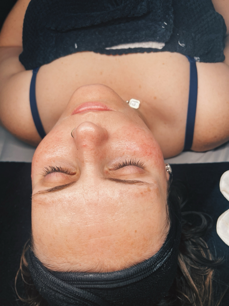 Enzyme Facial