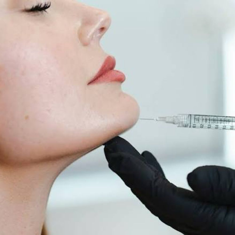 Chin Augmentation at Refyned Aesthetics & Wellness in Greenville, TX