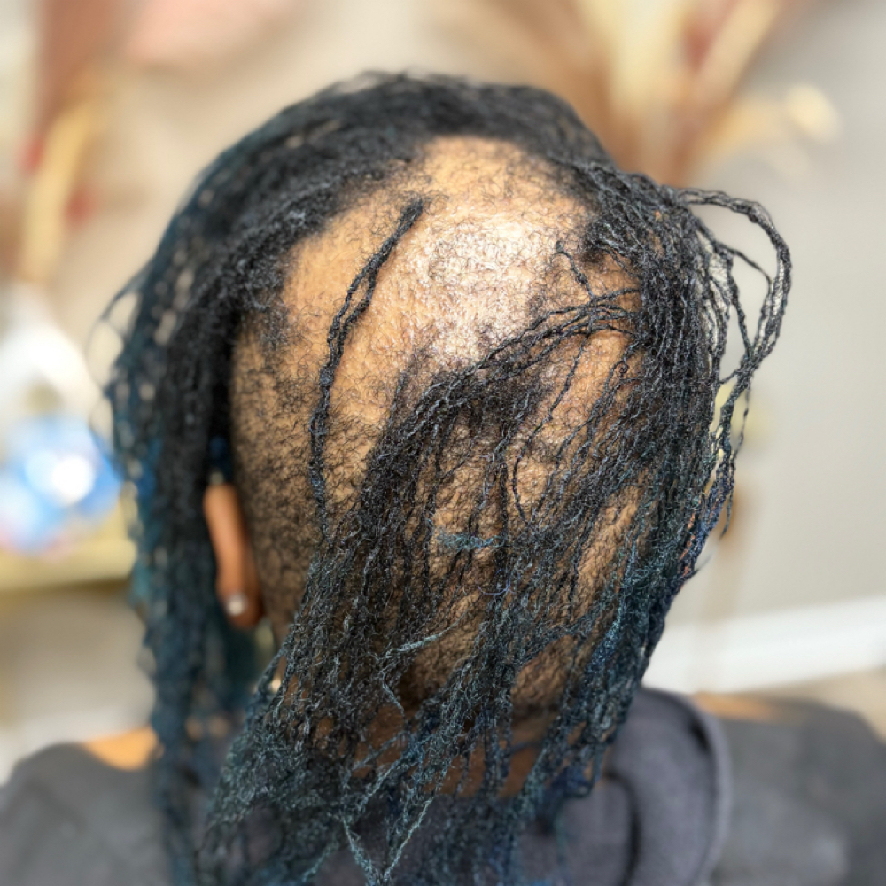 Loc Toupee Consultation at 𝐀𝐧𝐨𝐢𝐧𝐭𝐞𝐝 𝐋𝐨𝐜𝐬™ 𝐓𝐫𝐢𝐜𝐡𝐨𝐥𝐨𝐠𝐲 𝐒𝐭𝐮𝐝𝐢𝐨𝐬 in Chicago, IL