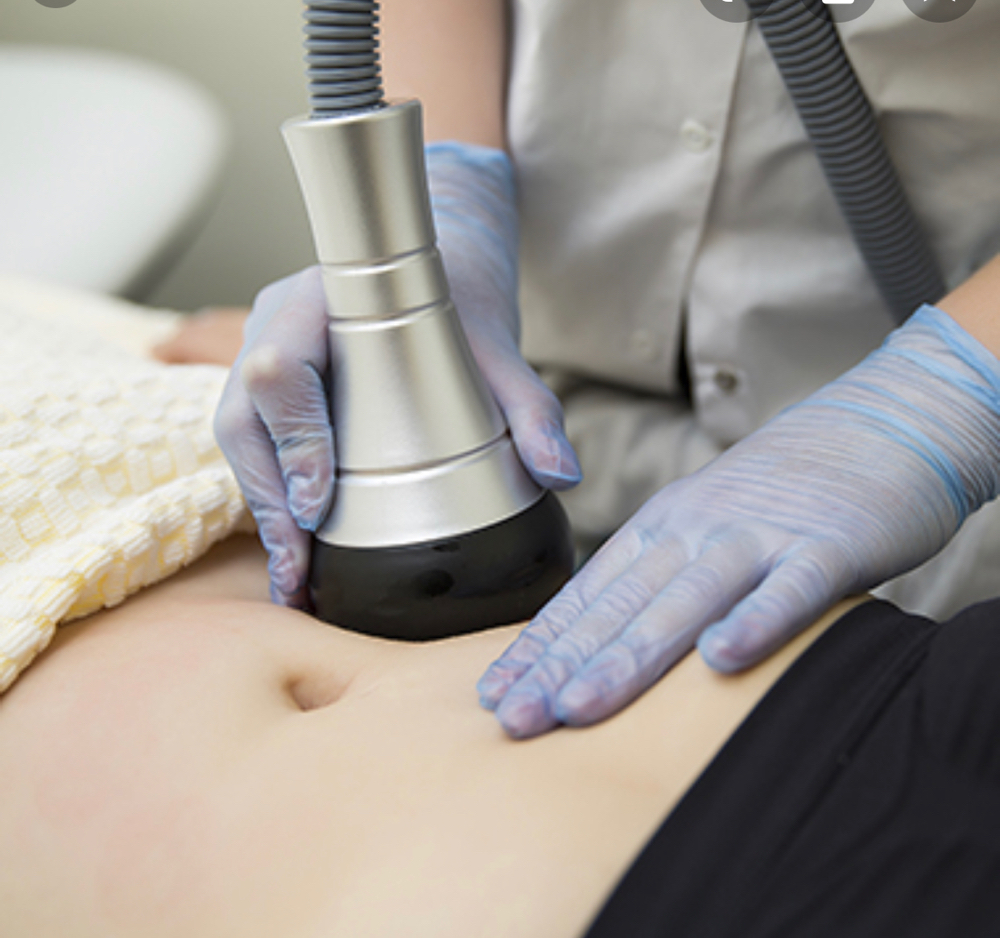 Body Cavitation, RF Skin Tightening