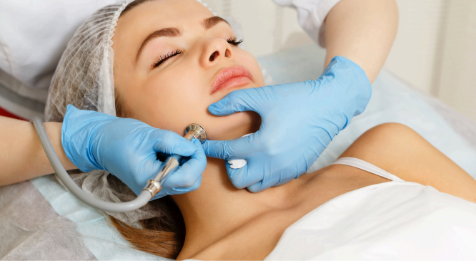 Microdermabrasion Renewal Treatment