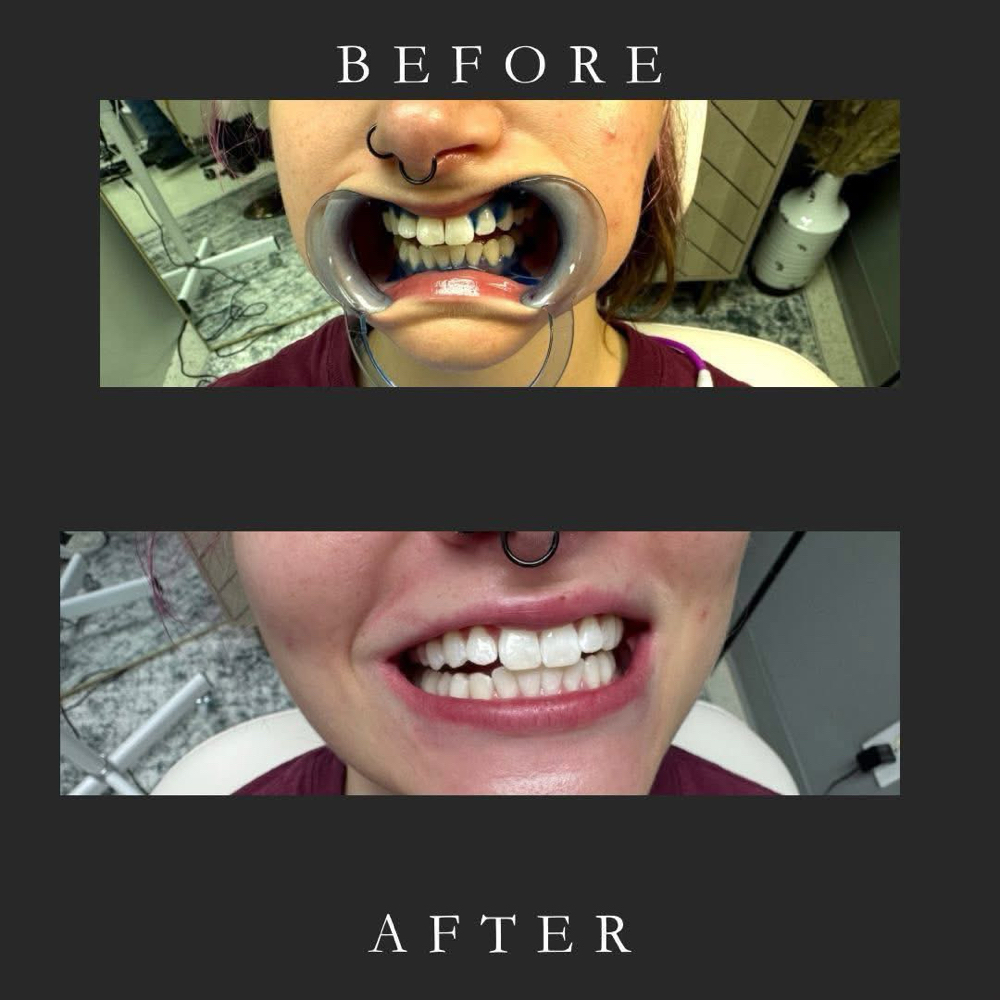 Sensitive Treatment at ACE Smiles in Mayodan, NC