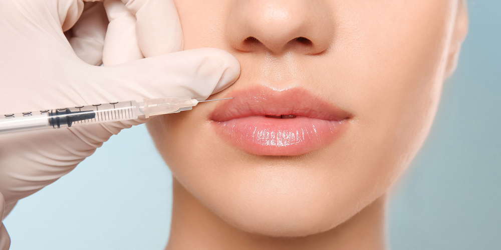 Dermal Fillers