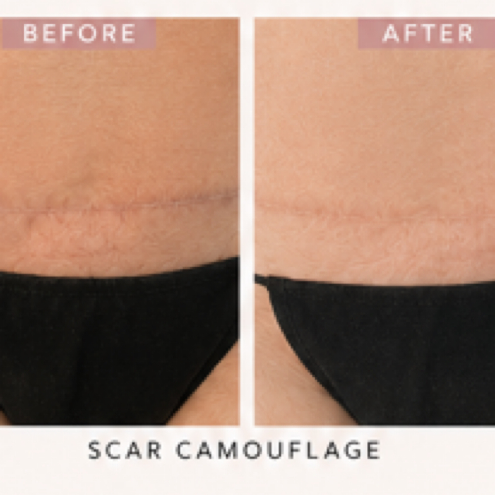 Small Scar Camouflage at Skin Theory Collective in Port Richey, FL