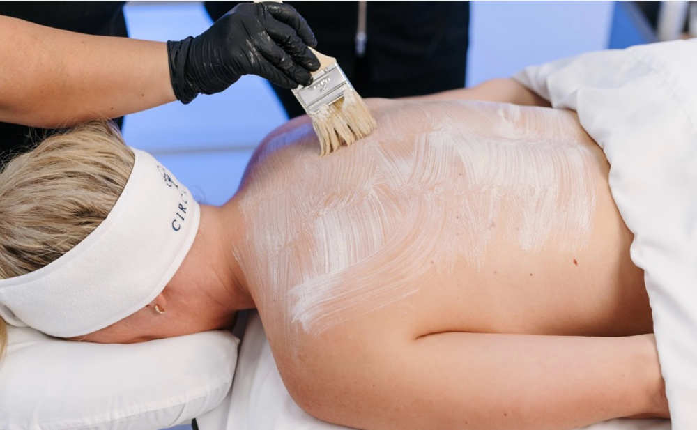 Back Facial+ Chem Peel