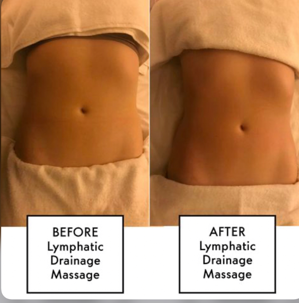 Pre And Post Op Lymphatic massage
