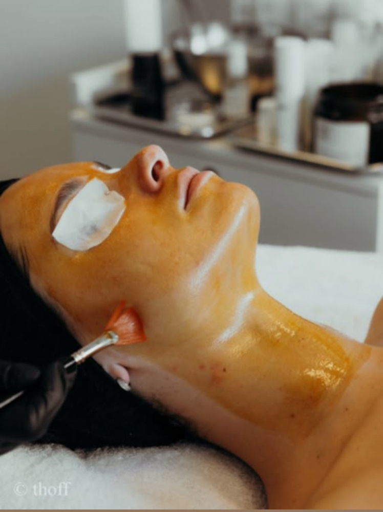 Advanced Renewal Peel