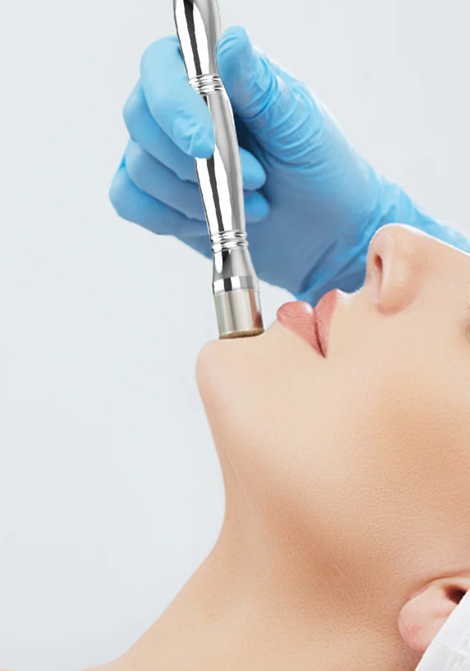 Microdermabrasion