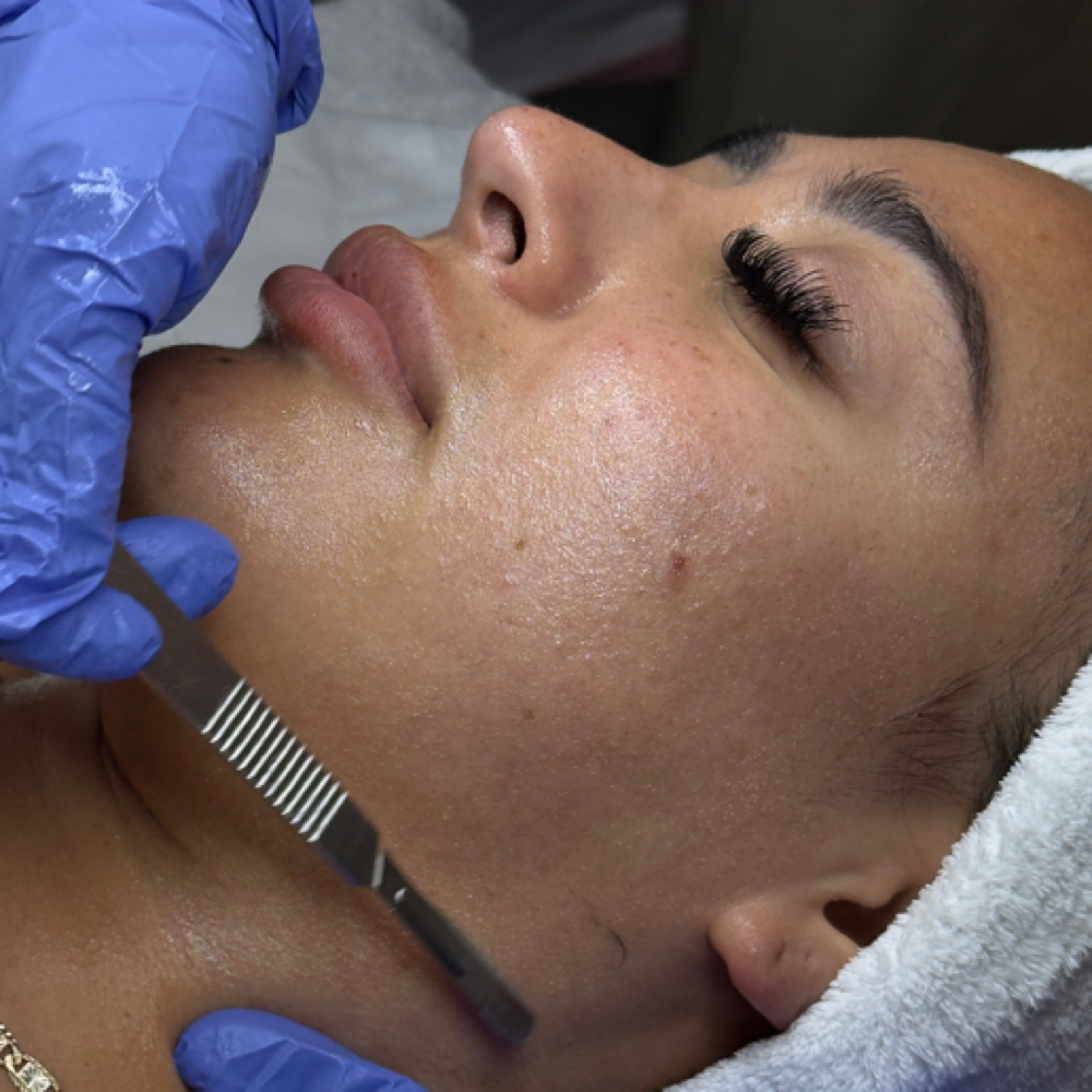 Dermaplane Add-On at Alina Aesthetics in Cedar Park, TX