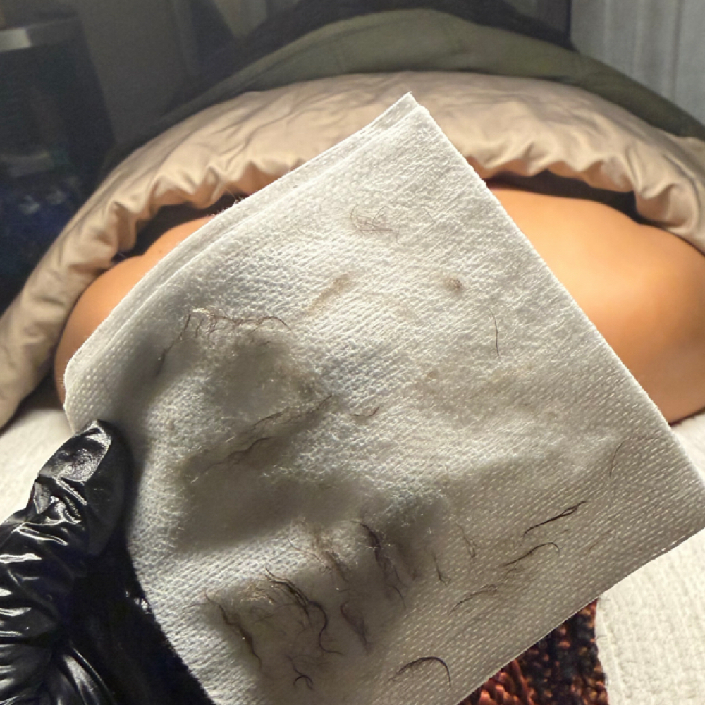 Dermaplane Express Facial at 3eleven Skin in Las Vegas, NV