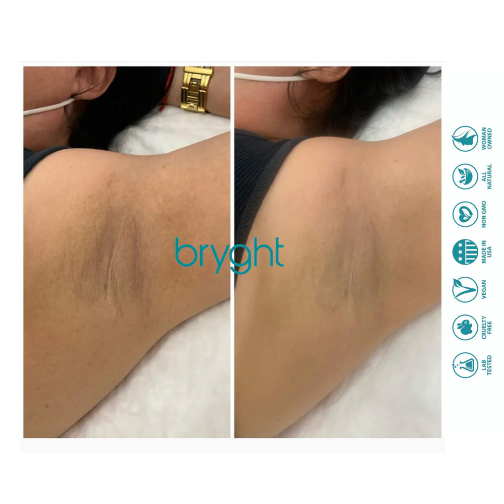 Brighten up buttercup•Small Area at Jisell Aesthetics in Houston, TX