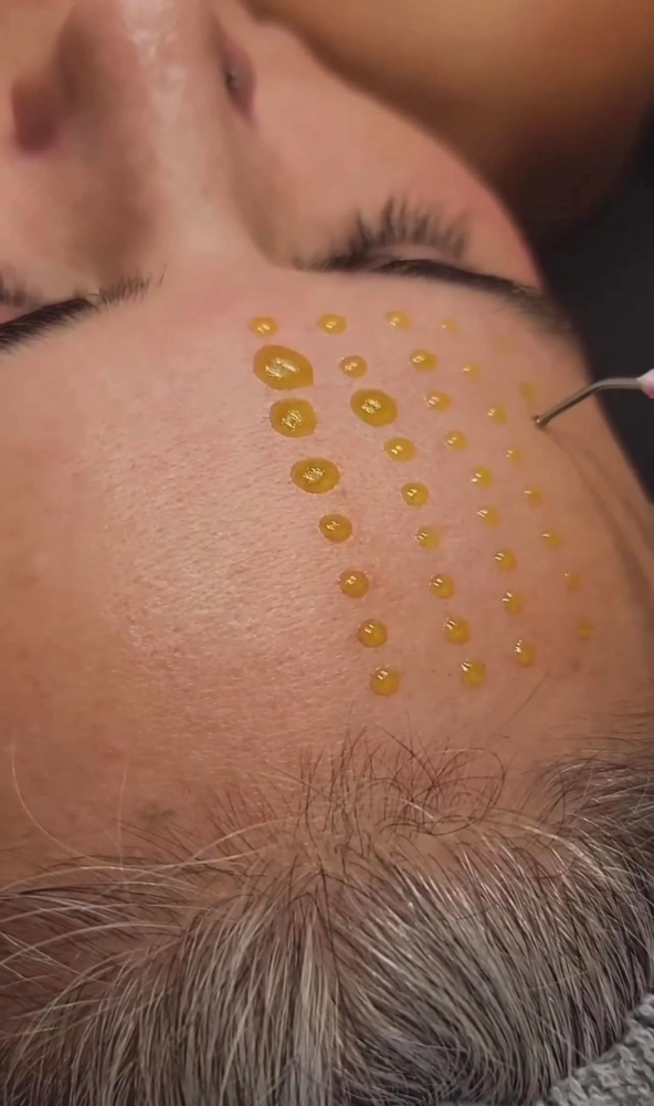BioRePeel Single Treatment Facial