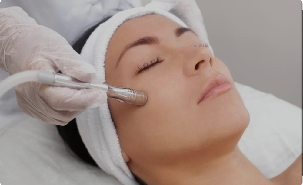 Microdermabrasion Facial