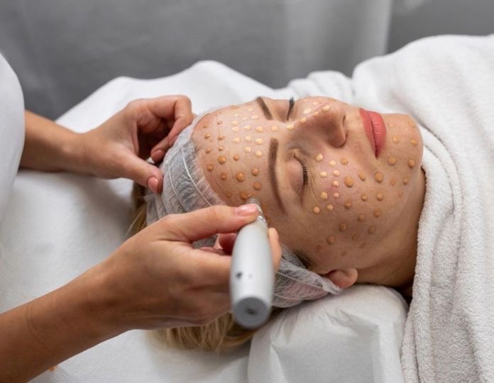 BB Glow Treatment at Zoraya Velez AESTHETICIAN in Richmond, VA