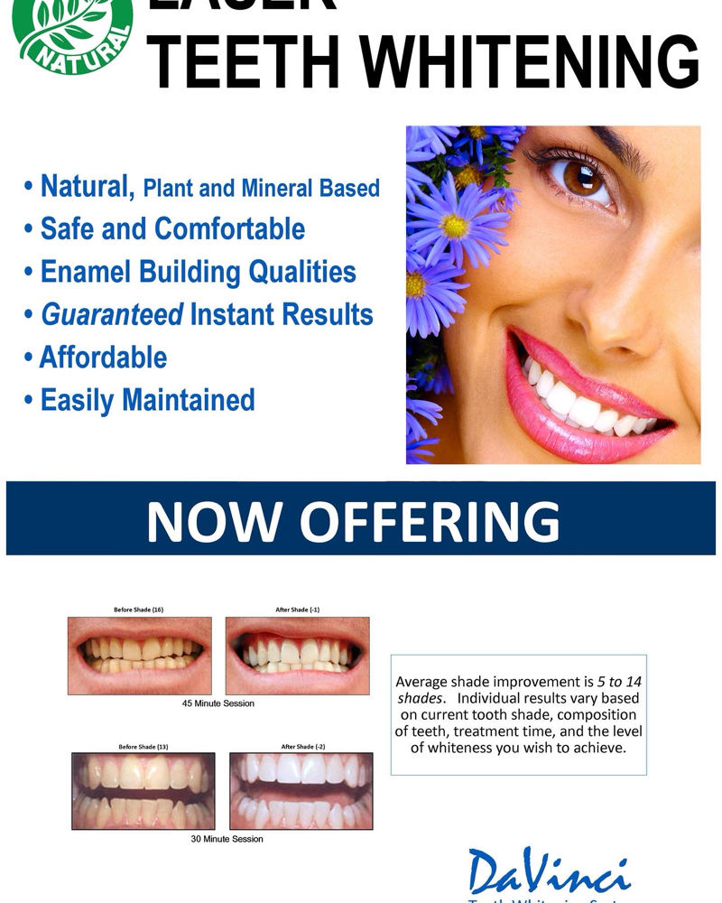 Davinci Teeth Whitening at Honey salon and Beauty Bar in Spokane Valley, WA