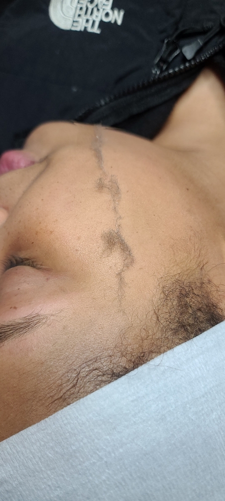 Dermaplaning Facial