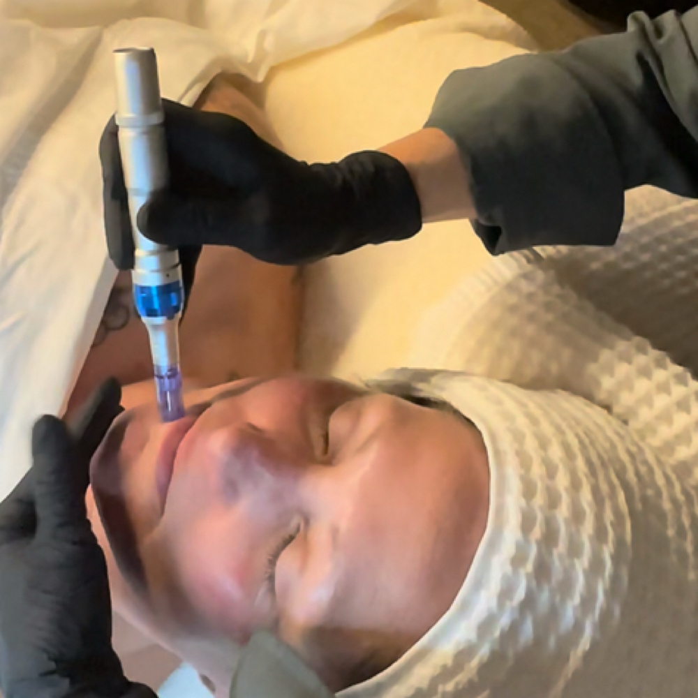 Infuse.Plump.Lift Nano Facial at Total Skin Method by KM